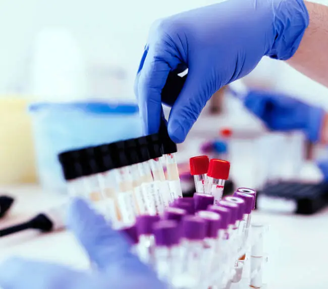 Diagnostic Sample Studies