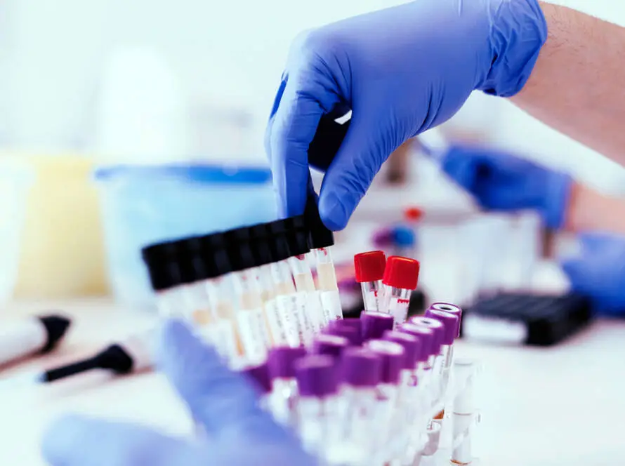 Diagnostic Sample Studies