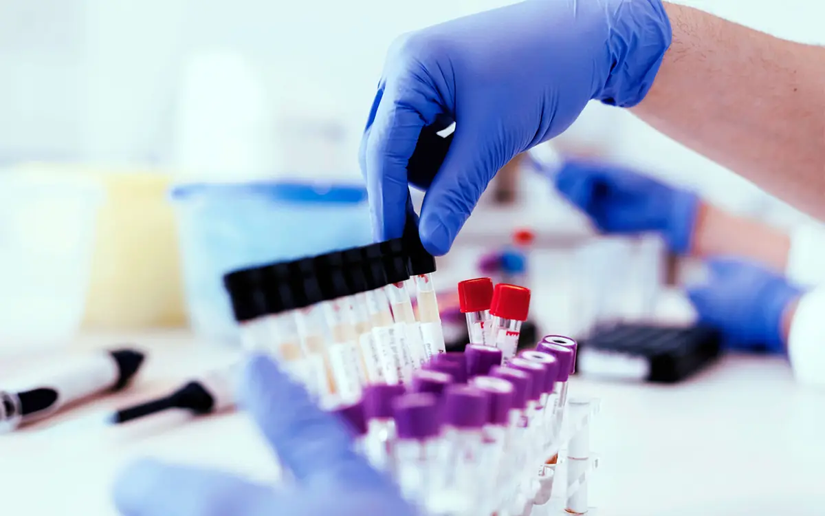 Diagnostic Sample Studies